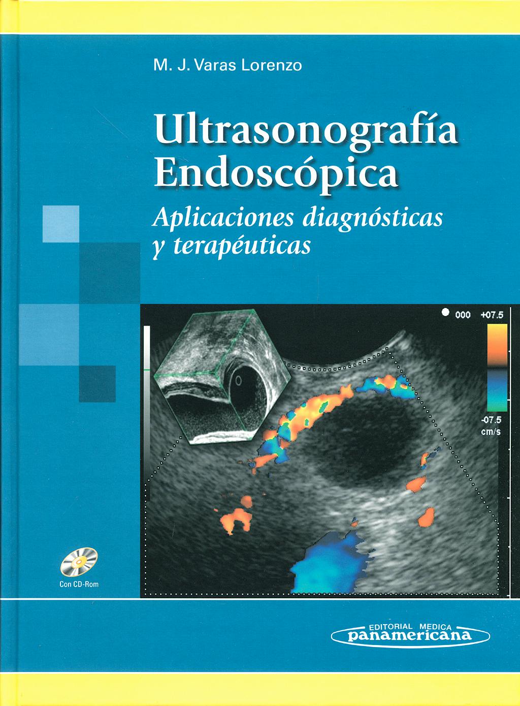 Ultrasonografía Endoscópica Aplicaciones Diagnósticas y Terapéuticas