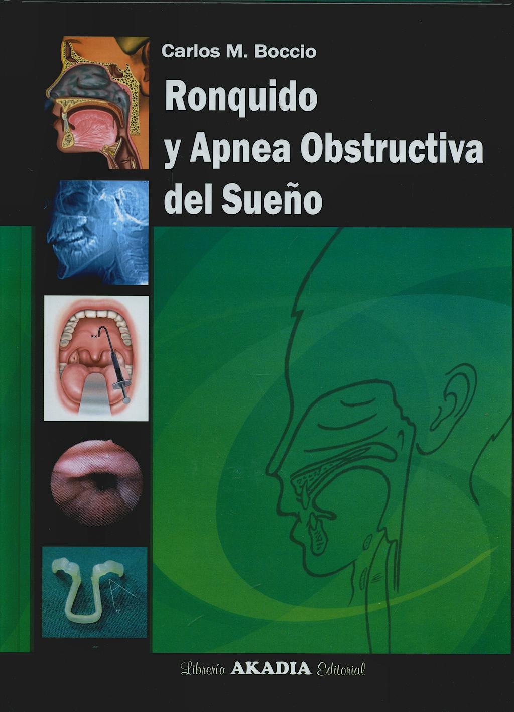 Ronquido y Apnea Obstructiva del Sueño 9789875701137 Boccio C axon es