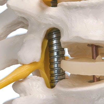 Columna Vertebral Extra Resistente con Cabezas de Fémur