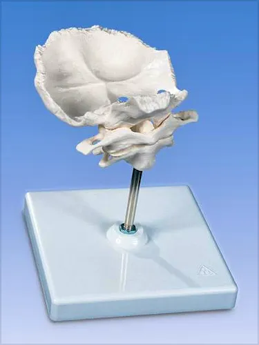 Atlas y Axis con Placa Occipital + Soporte