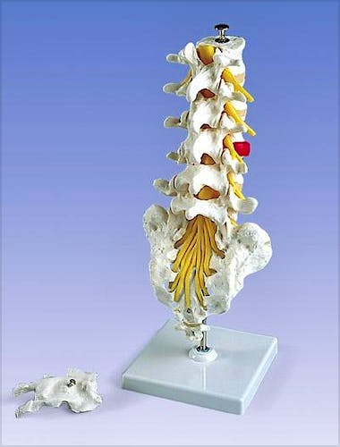 Columna Lumbar + Hernia de Disco Dorsolateral