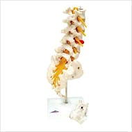 Columna Lumbar + Hernia de Disco Dorsolateral
