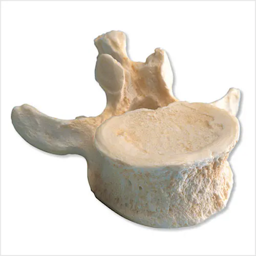 Set de 5 Vértebras Lumbares