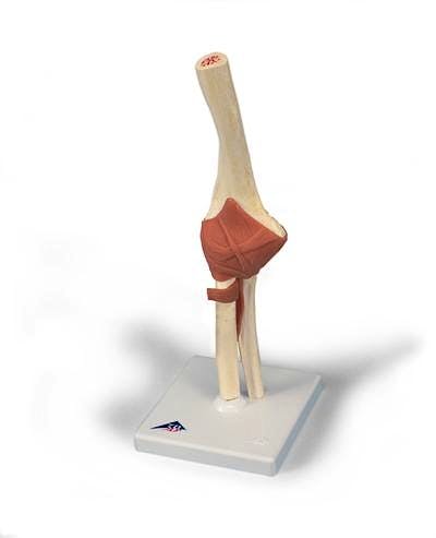 Modelo Funcional de la Articulación del Codo de Lujo