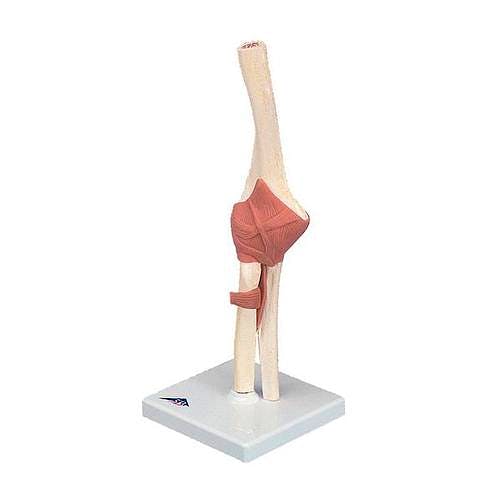 Modelo Funcional de la Articulación del Codo de Lujo