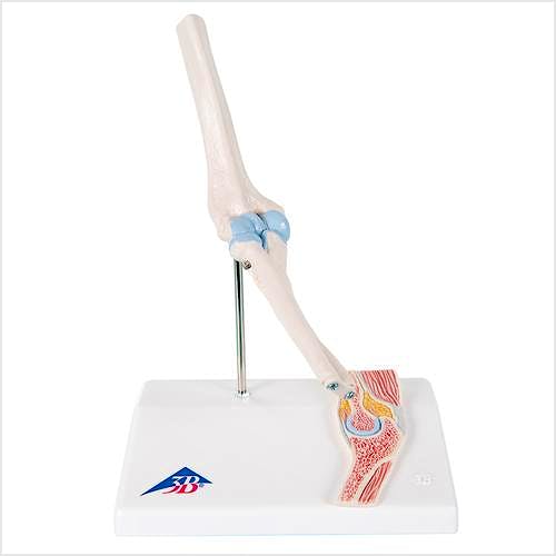 Mini Articulación del Codo con Sección Mediana