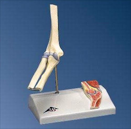 Mini Articulación del Codo con Sección Mediana