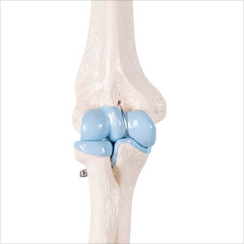 Mini Articulación del Codo con Sección Mediana