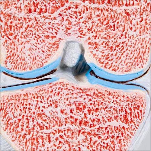 Modelo de la Articulacion de la Rodilla Dividido en 3 Partes