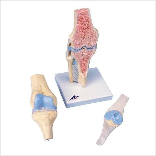 Modelo de la Articulacion de la Rodilla Dividido en 3 Partes