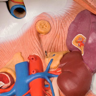 Torso Clásico Asexuado, 12 Partes