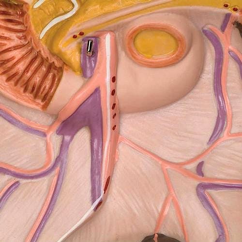 Torso Clasico Asexuado, 16 Partes