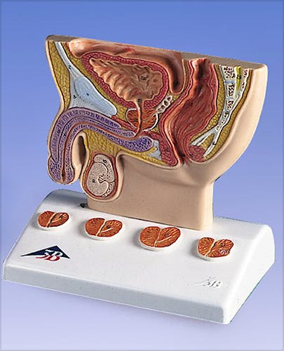 Modelo de Próstata