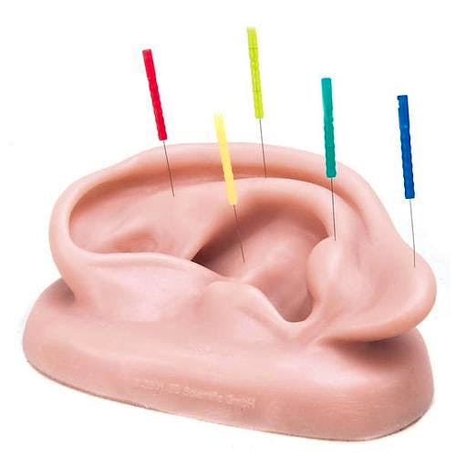 Acupuntura de la Oreja (Izquierda)