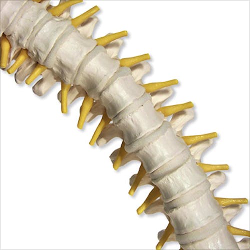 Columna Vertebral con Discos Intervertebrales Suaves