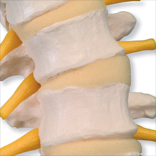 Columna Vertebral con Discos Intervertebrales Suaves