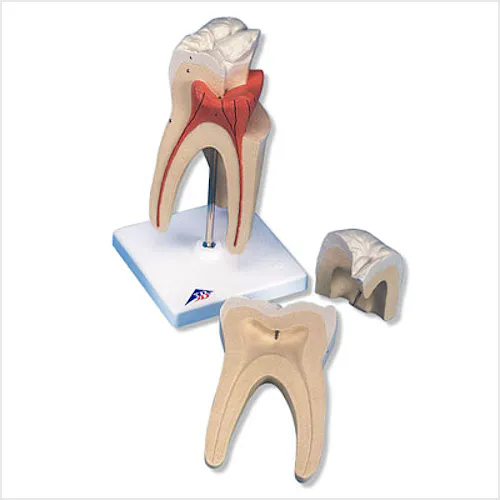 Molar Superior de Tres Raíces