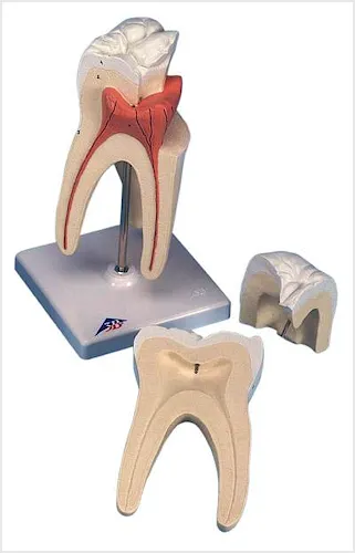 Molar Superior de Tres Raíces