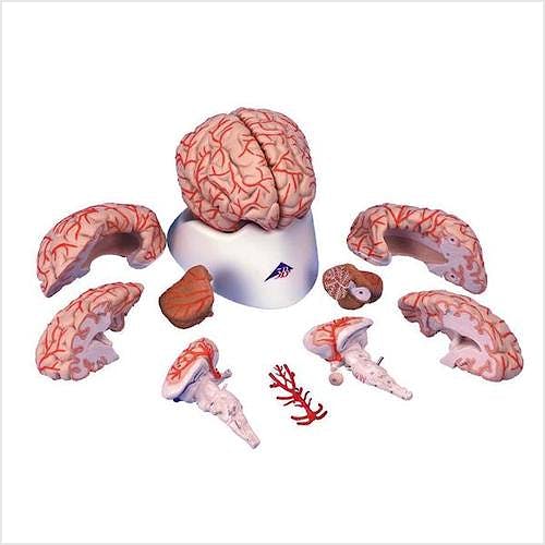 Cerebro de Lujo con Arterias, 9 Partes