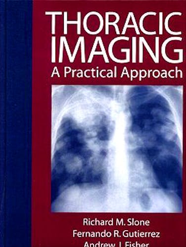 Portada del libro 9780070582231 Thoracic Imaging. a Practical Approach