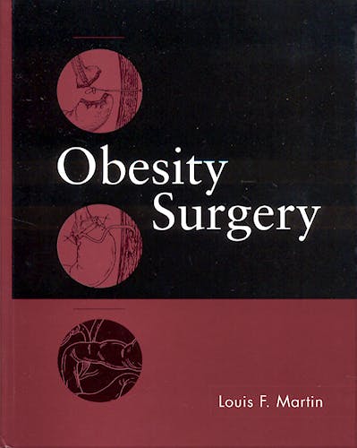 Portada del libro 9780071406406 Obesity Surgery