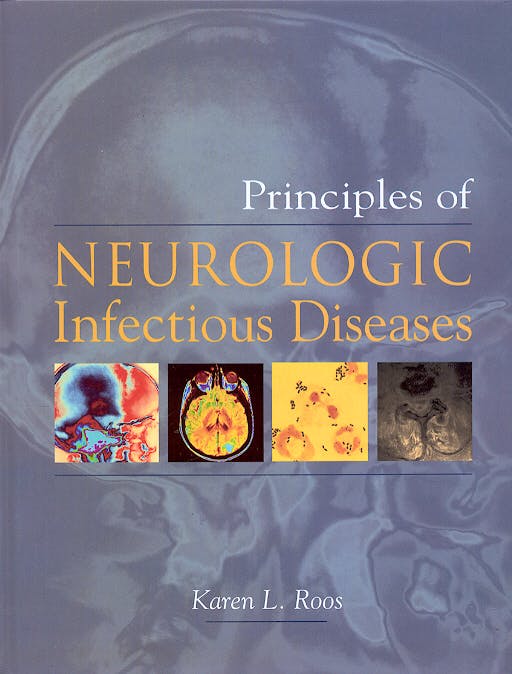 Portada del libro 9780071408165 Principles of Neurologic Infectious Diseases