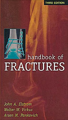Portada del libro 9780071443777 Handbook of Fractures