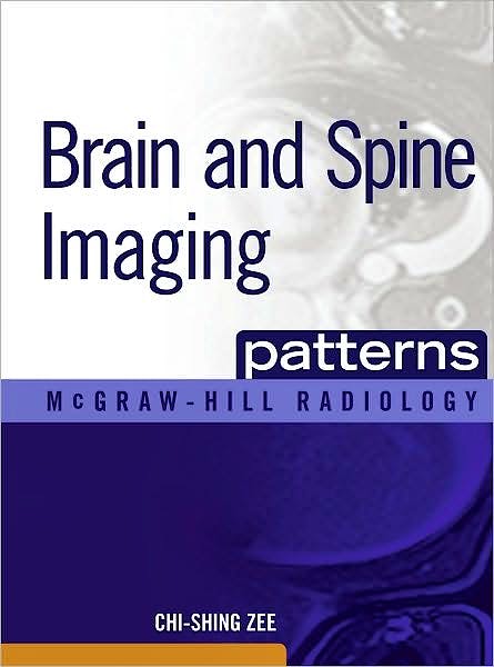 Portada del libro 9780071465410 Brain and Spine Imaging Patterns