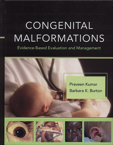 Portada del libro 9780071471893 Congenital Malformations. Evidence-Based Evaluation and Management