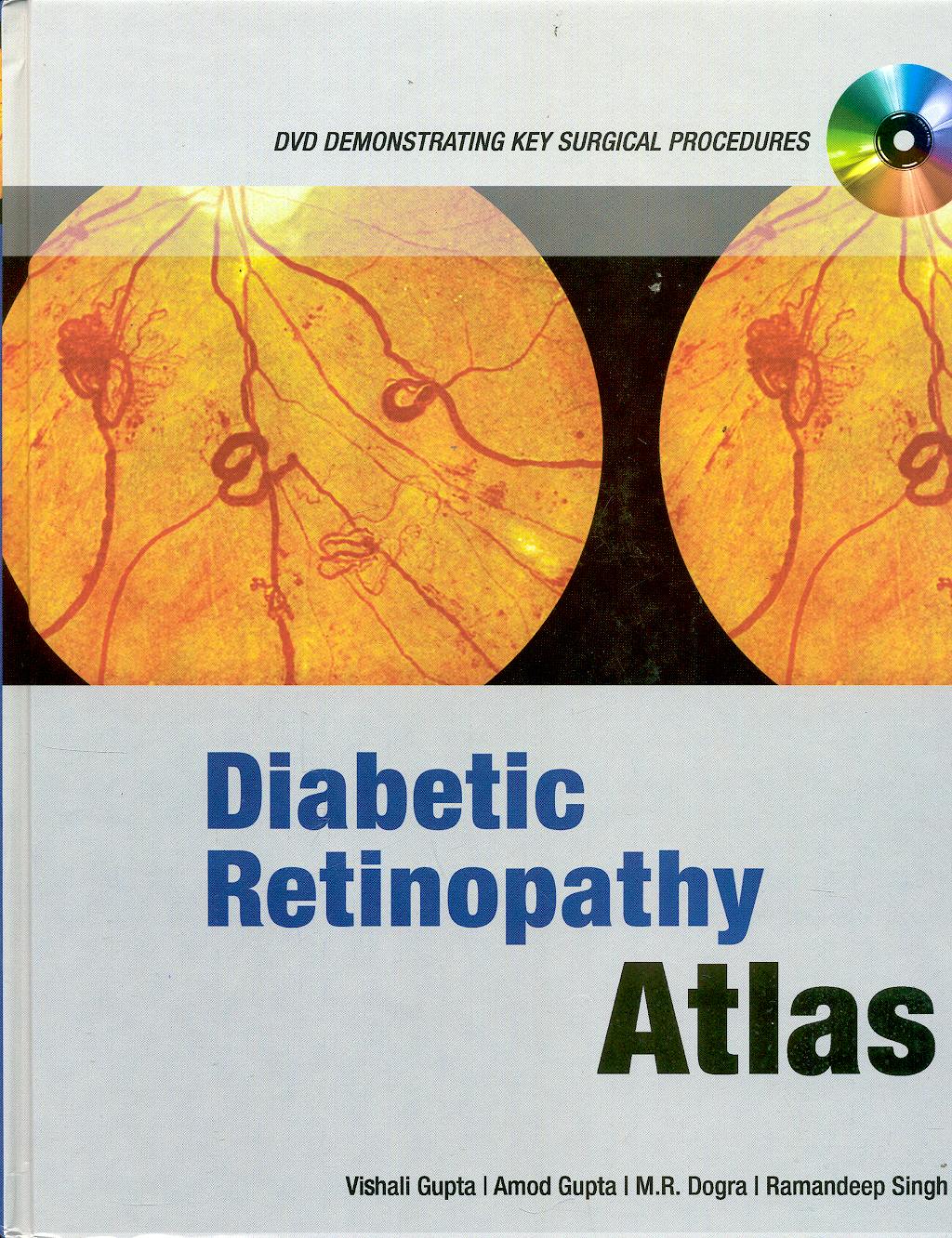 Portada del libro 9780071601832 Diabetic Retinopathy Atlas