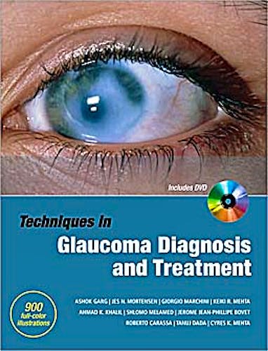 Portada del libro 9780071601955 Techniques in Glaucoma Diagnosis and Treatment