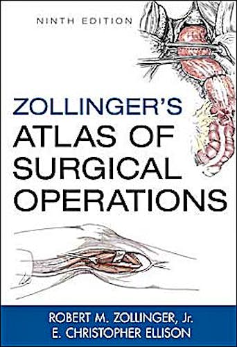 Portada del libro 9780071602266 Zollinger's Atlas of Surgical Operations
