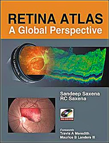Portada del libro 9780071634403 Retina Atlas. a Global Perspective