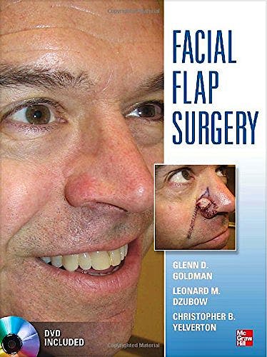 Portada del libro 9780071749251 Facial Flap Surgery