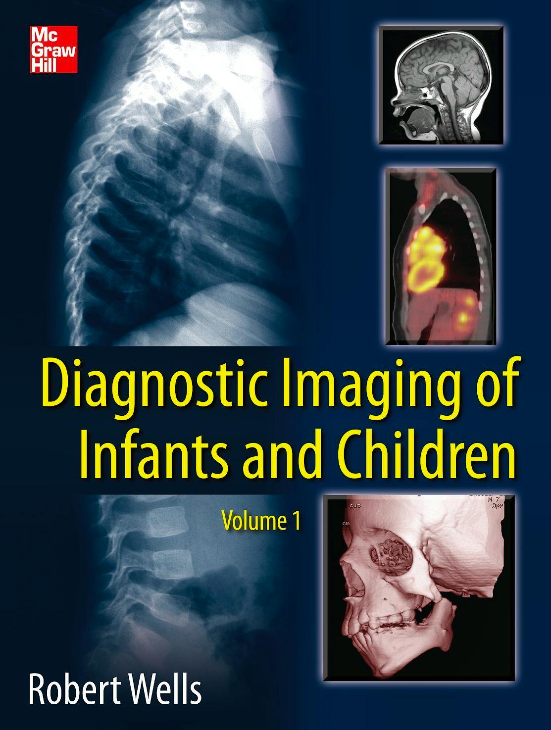 Portada del libro 9780071810036 Diagnostic Imaging of Infants and Children