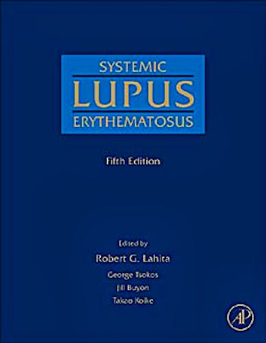 Portada del libro 9780123749949 Systemic Lupus Erythematosus