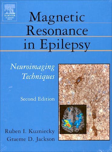 Portada del libro 9780124311527 Magnetic Resonance in Epilepsy: Neuroimaging Techniques