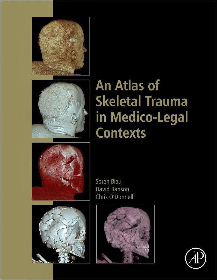 Portada del libro 9780128037591 An Atlas of Skeletal Trauma in Medico-Legal Contexts