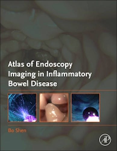 Portada del libro 9780128148112 Atlas of Endoscopy Imaging in Inflammatory Bowel Disease