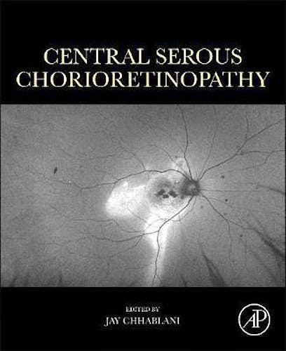 Portada del libro 9780128168004 Central Serous Chorioretinopathy