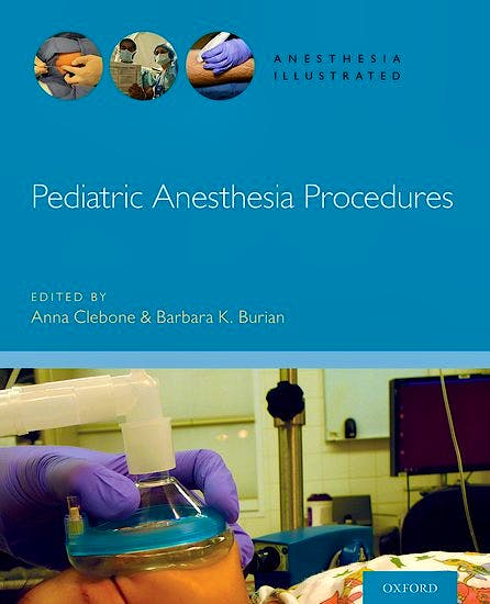 Pediatric Anesthesia Procedures: 9780190685188: Clebone, A. — Burian, B ...