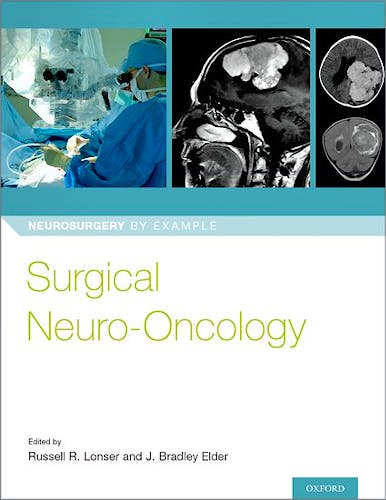 Portada del libro 9780190696696 Surgical Neuro-Oncology
