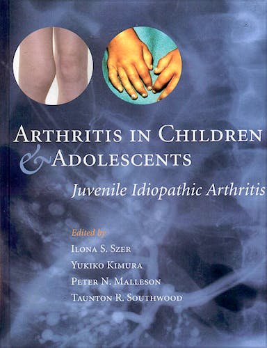 Portada del libro 9780192632920 Arthritis in Children & Adolescents: Juvenile Idiopathic Arthritis