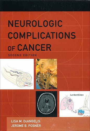 Portada del libro 9780195366747 Neurologic Complications of Cancer