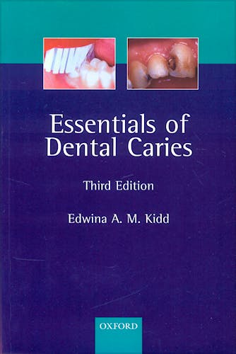 Portada del libro 9780198529781 Essentials of Dental Caries