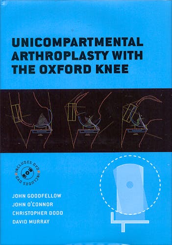 Portada del libro 9780198570523 Unicompartmental Arthroplasty with the Oxford Knee