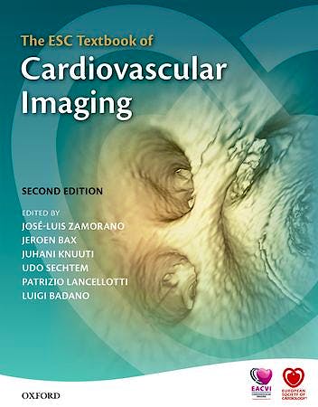 Portada del libro 9780198703341 The ESC Textbook of Cardiovascular Imaging