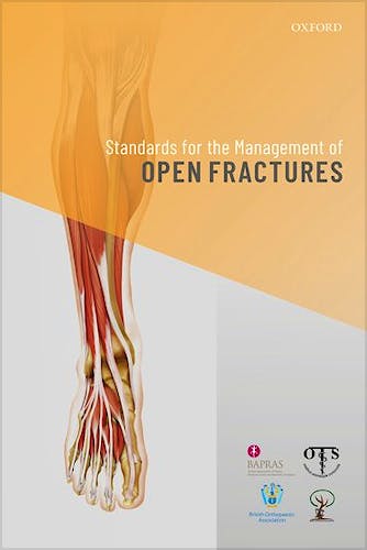 Portada del libro 9780198849360 Standards for the Management of Open Fractures