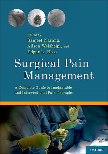 Portada del libro 9780199377374 Surgical Pain Management. A Complete Guide to Implantable and Interventional Pain Therapies