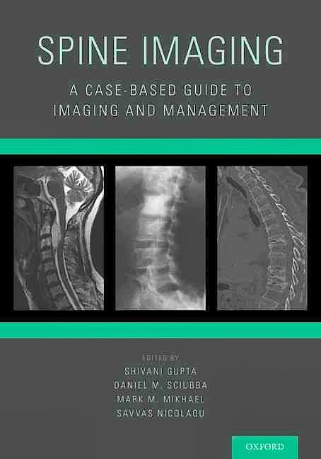 Portada del libro 9780199393947 Spine Imaging. a Case-Based Guide to Imaging and Management
